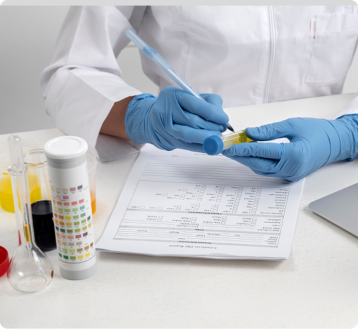 Urine Test - Little By Little